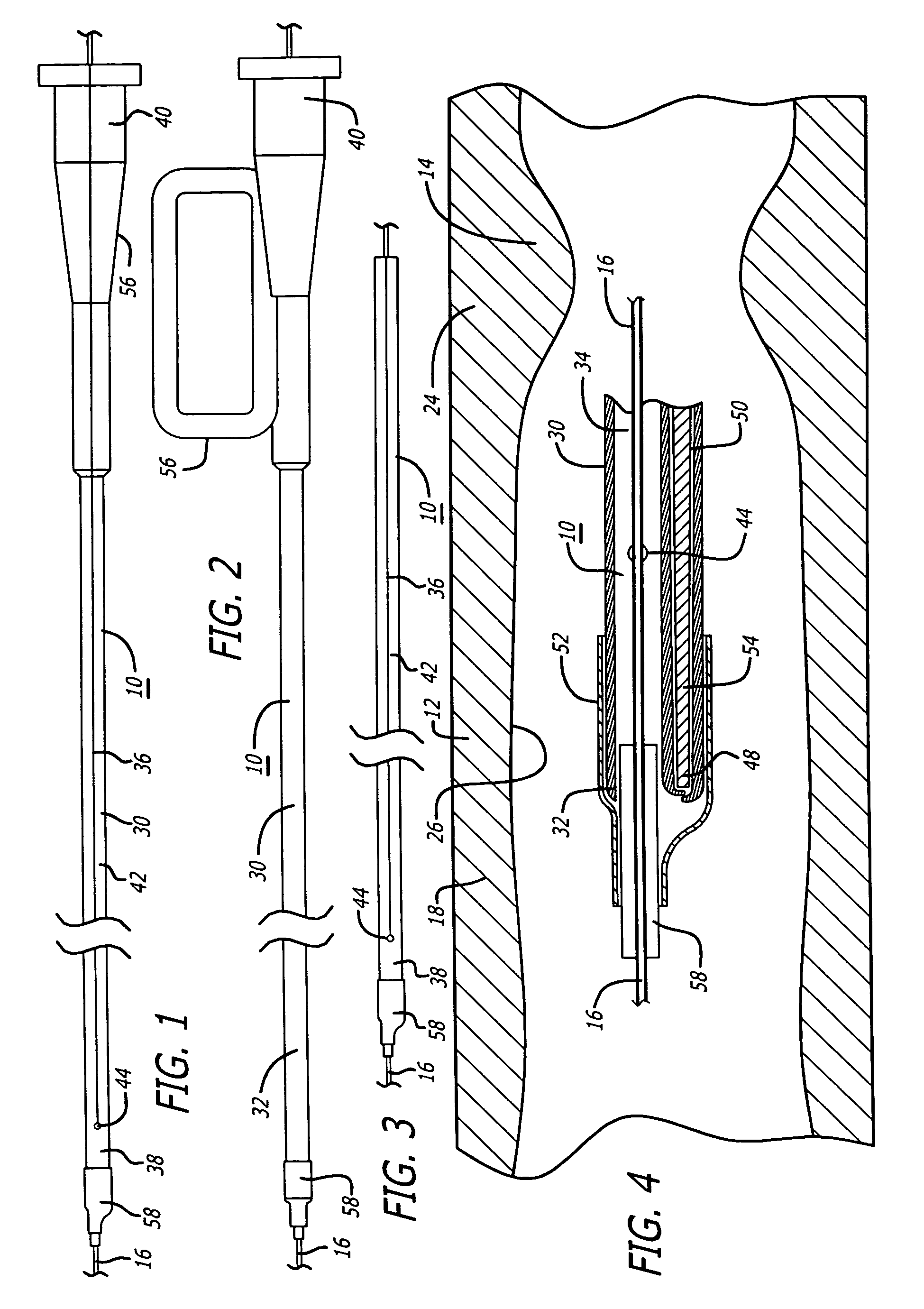 Delivery and recovery systems having steerability and rapid exchange operating modes for embolic protection systems