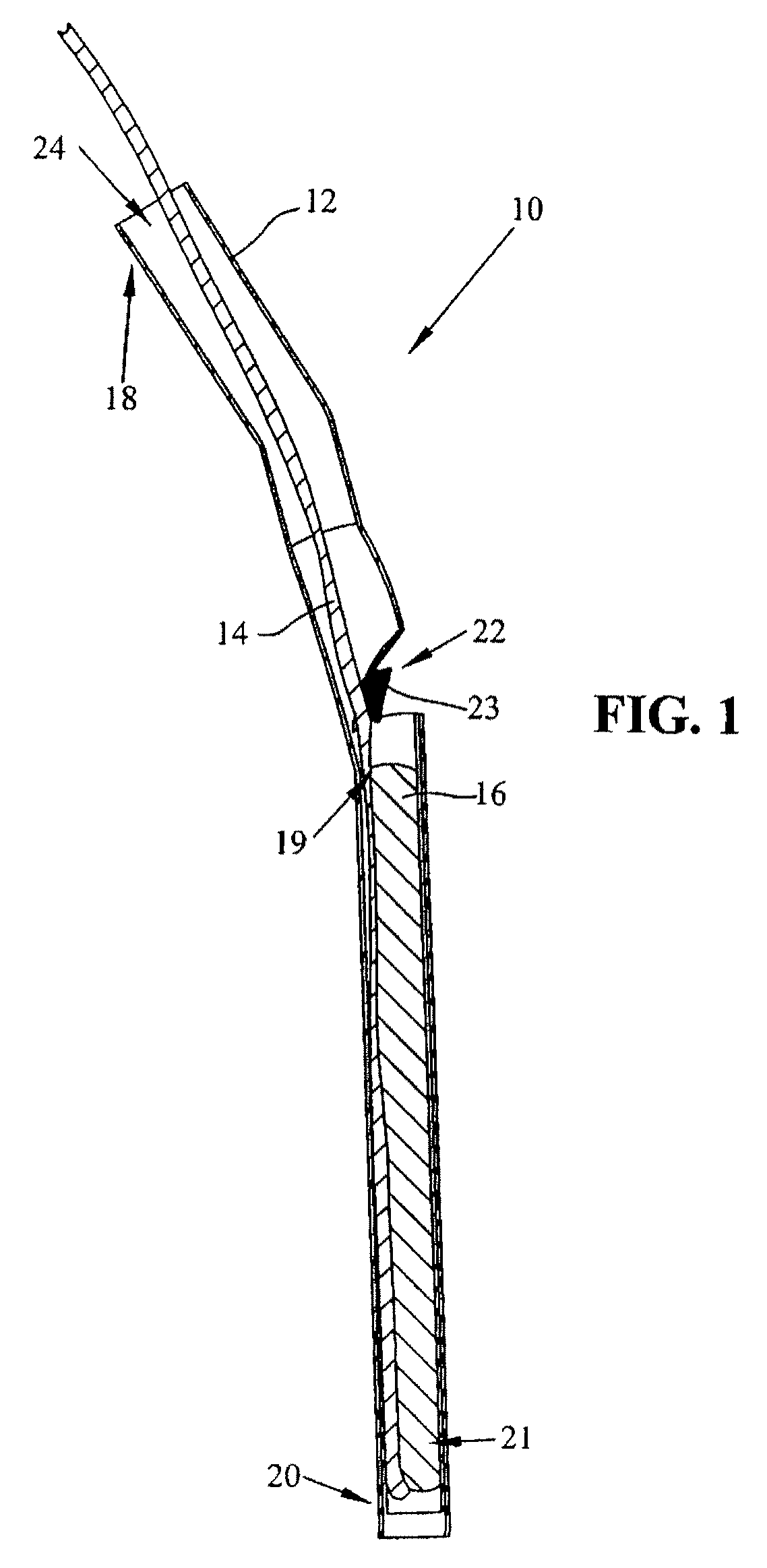 Apparatus and method for prophylactic hip fixation