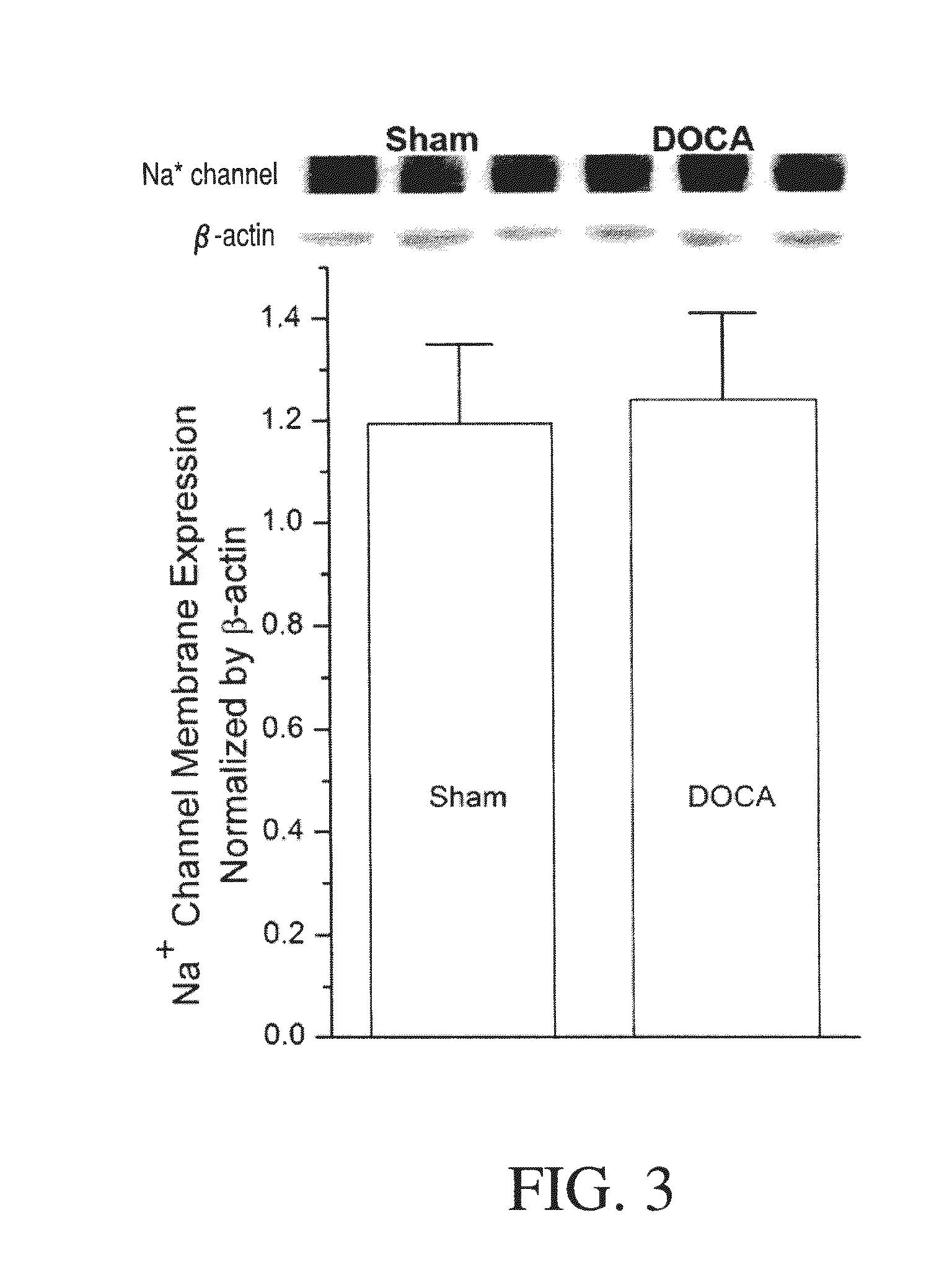 Method for Ameliorating or Preventing Arrhythmic Risk Associated with Cardiomyopathy