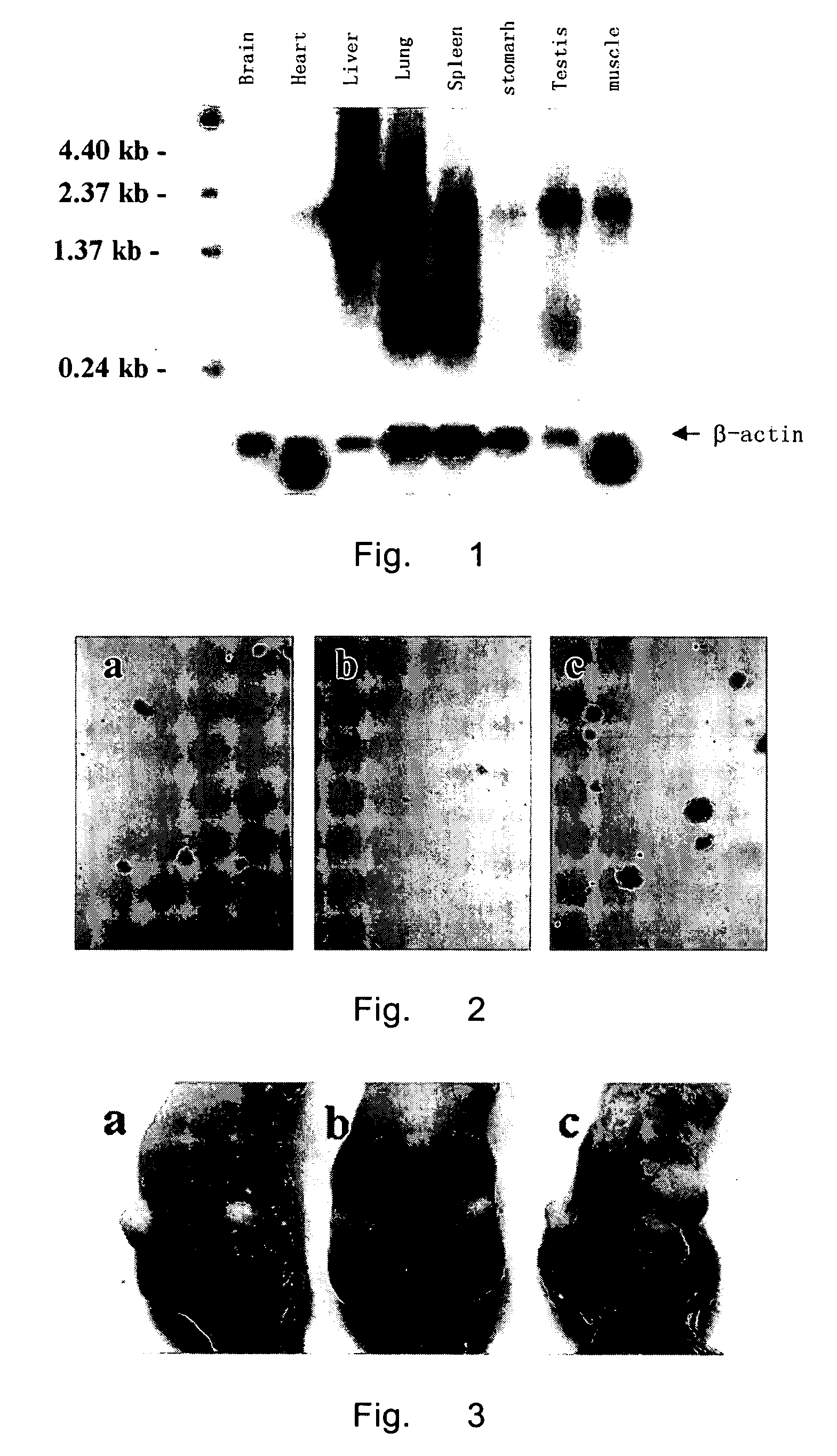 Tumor-inhibiting protein and the use thereof