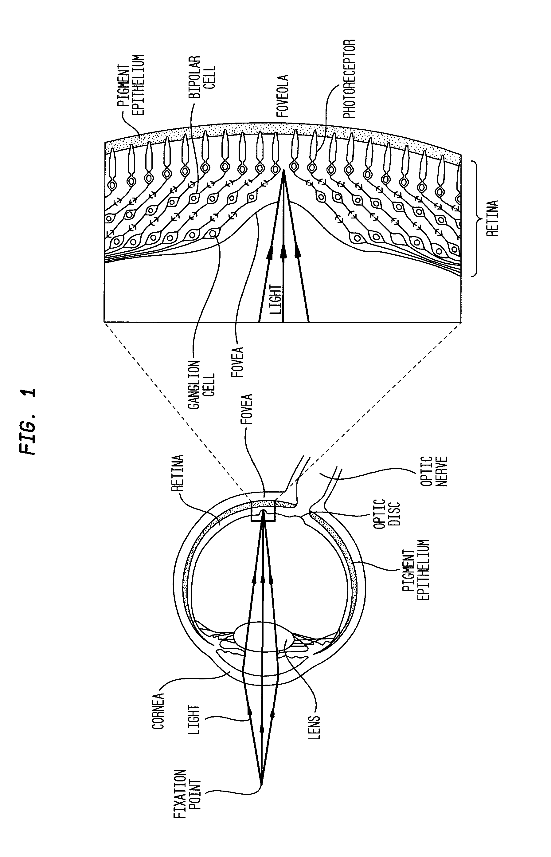 Compositions and methods for reducing visual loss