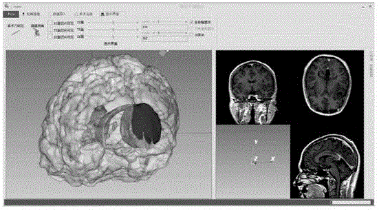 Neurosurgery brain operation typical medical history training system