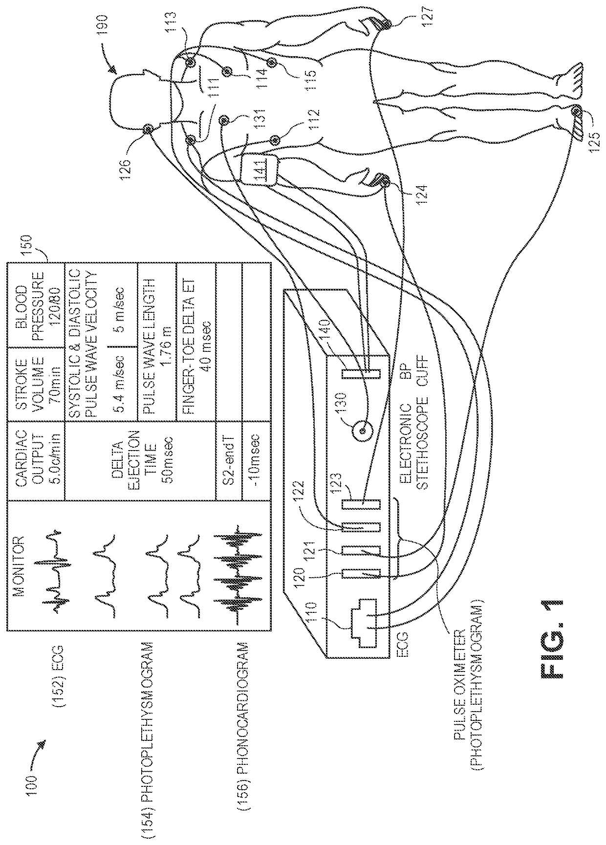 Device and method to measure ventricular arterial coupling and vascular performance