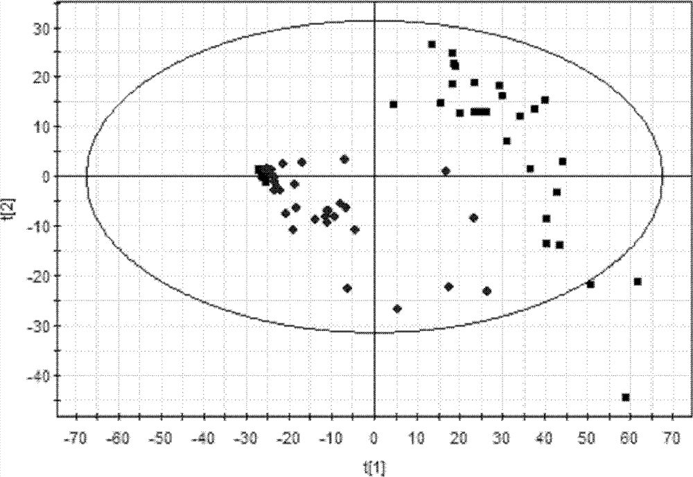 Bladder cancer patient urine specific metabolite spectrum, establishing method and application