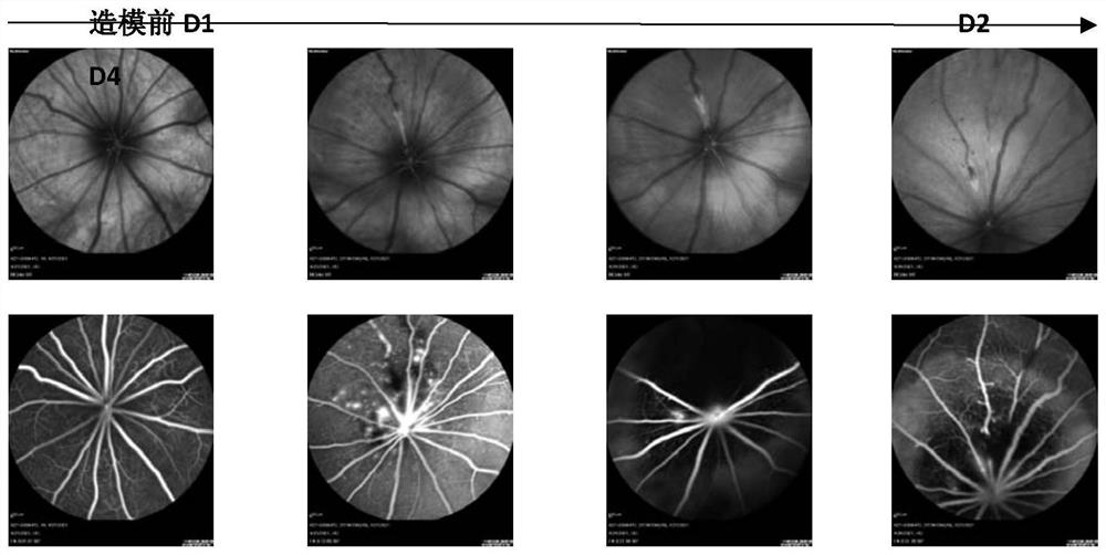 Ophthalmic preparation for treating macular edema, optic neuritis and non-infectious entophthalmia through eye drop administration