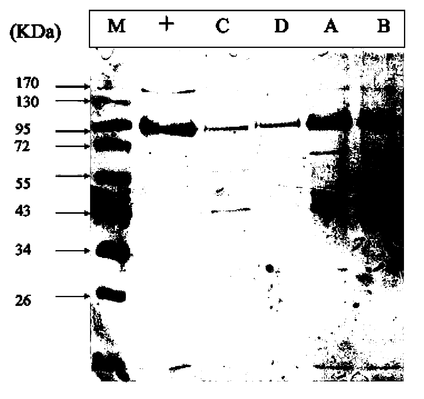 Method for separating and purifying recombinant human coagulation factor VIII from cell culture fluid