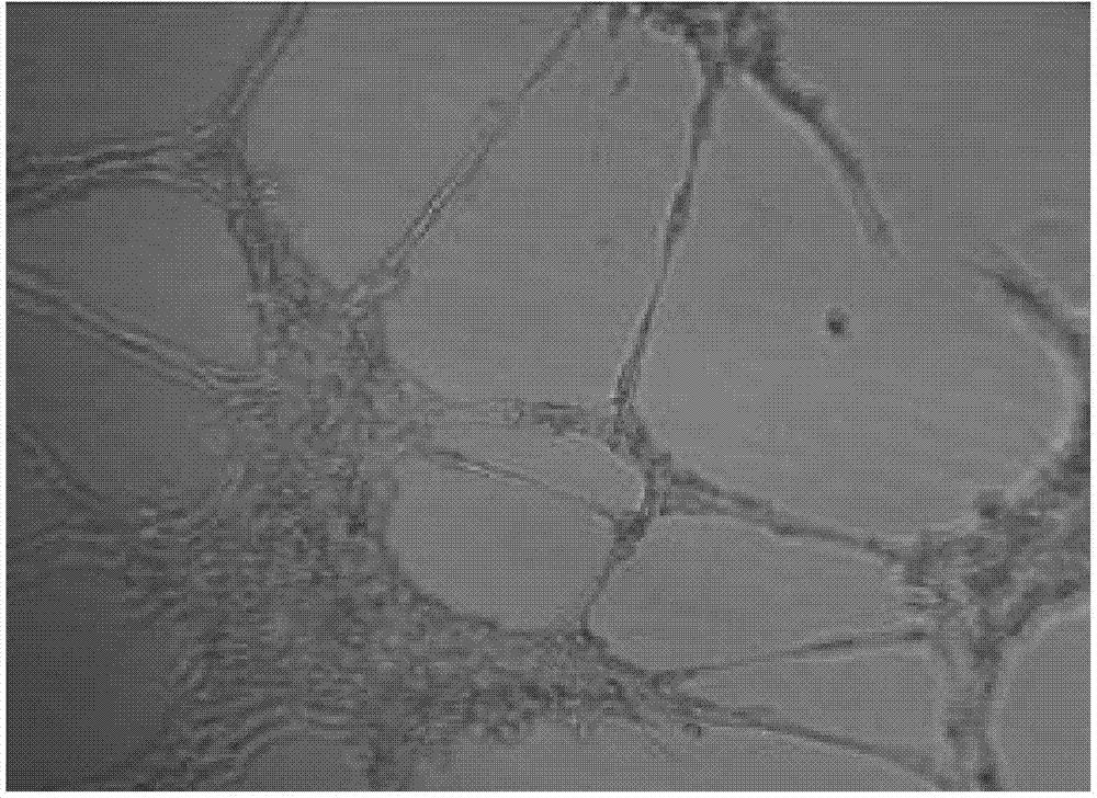 2-undecyl-3-methyl-hydroxyl-quinoline compound as well as preparation method, pharmaceutical composition and use thereof