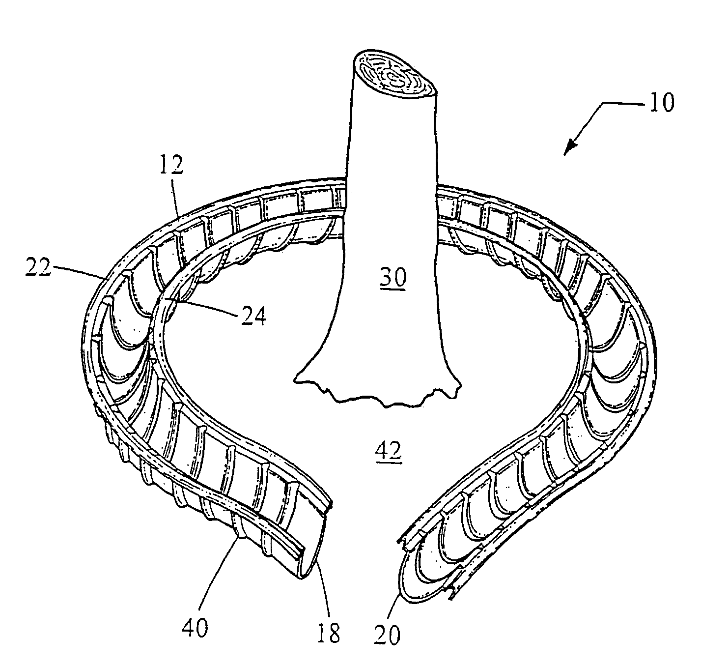 Planting receptacle assembly and a method for planting
