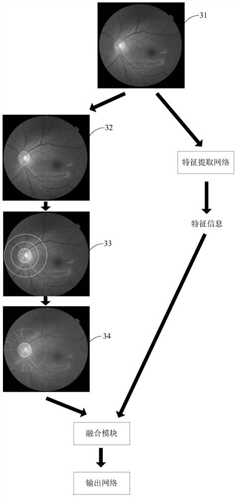 Psychological state recognition method and equipment based on fundus image