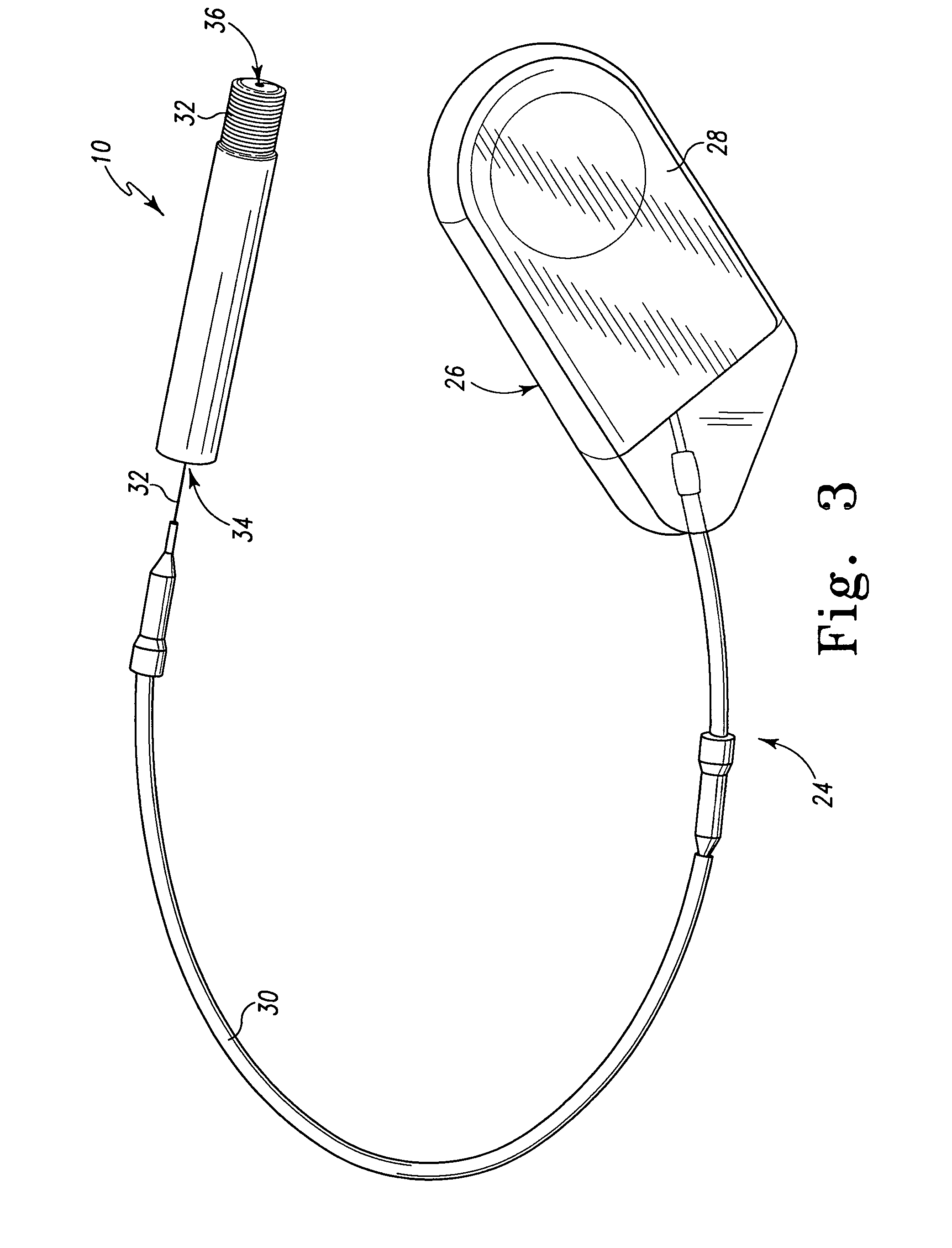 Methods and devices for treatment of osteonecrosis of the femoral head with core decompression