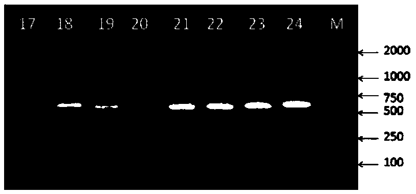 Method and primer for detecting 8th and 25th whole exons of TEX11 gene