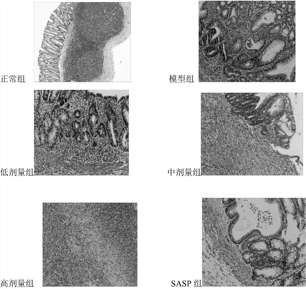 Compound combined medicine for treating ulcerative colitis and preparation method and application thereof