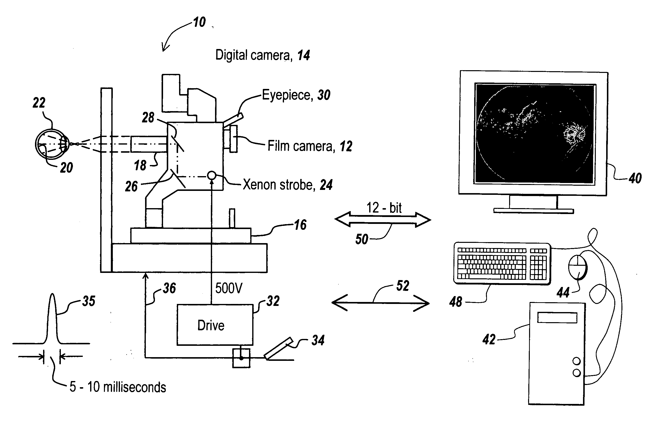 Haze reduction method and apparatus for use in retinal imaging