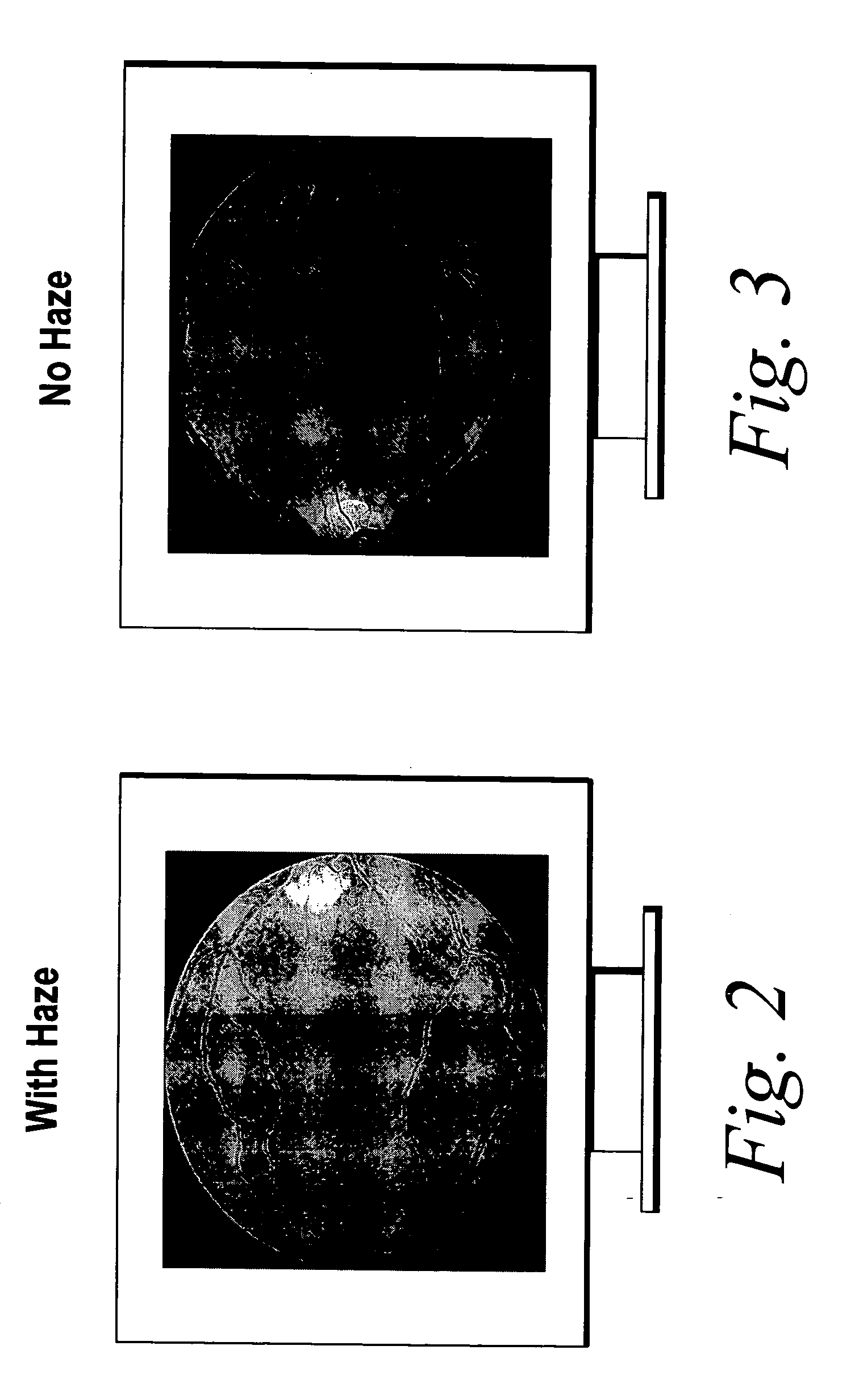 Haze reduction method and apparatus for use in retinal imaging