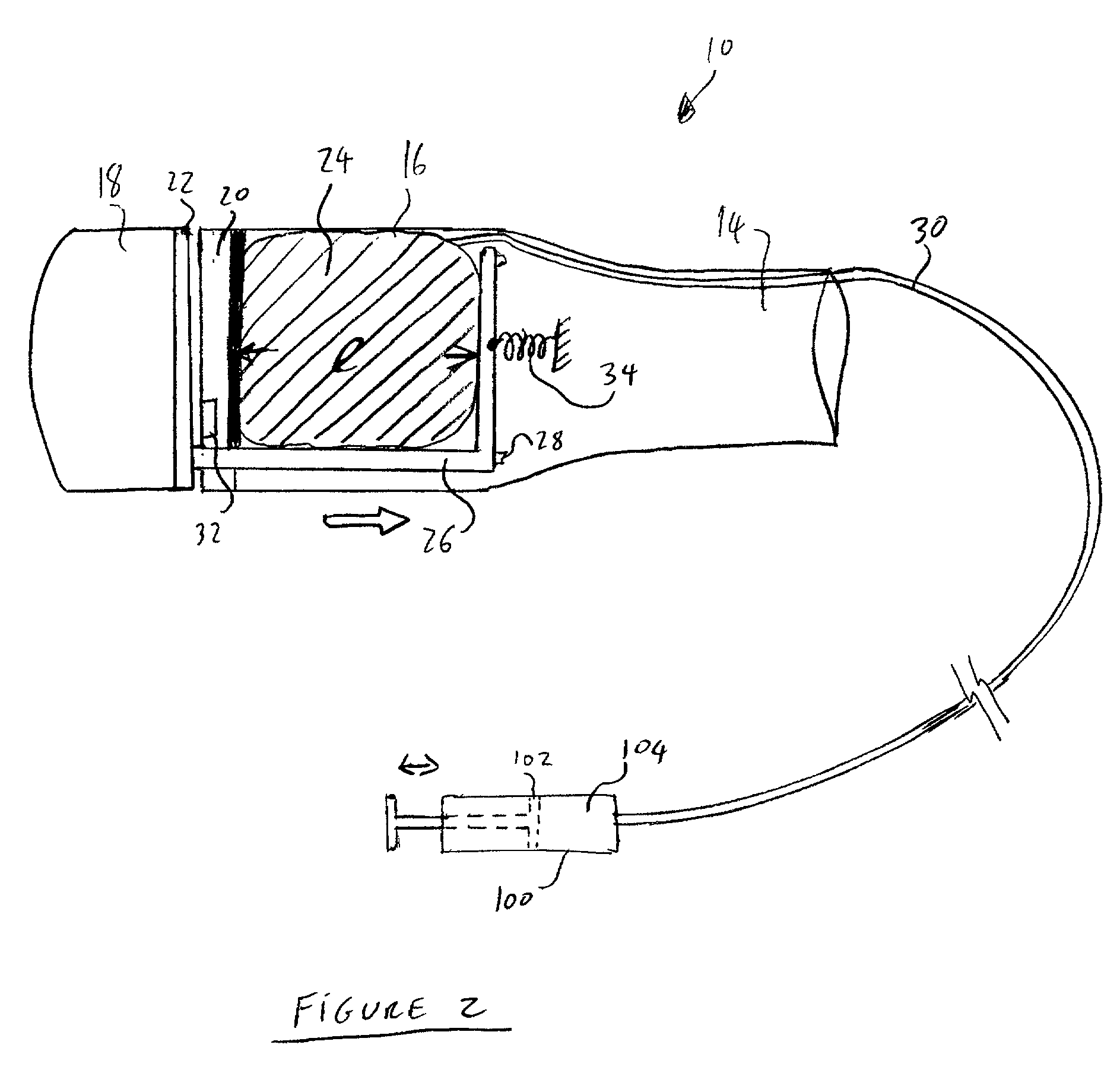 Balloon actuator for use in a resectioning device