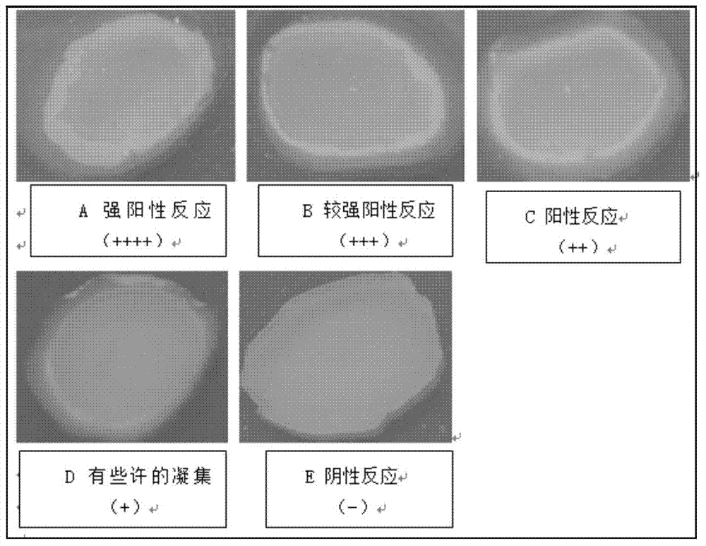 Enterohemorrhagic E.coli O157:H7 latex agglutination detection kit and application thereof