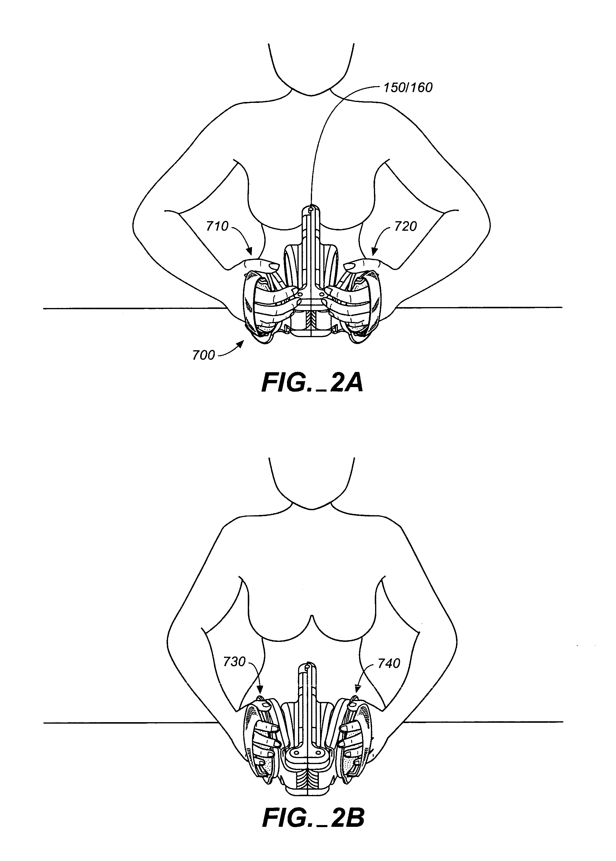 Breast sculpting exercise apparatus