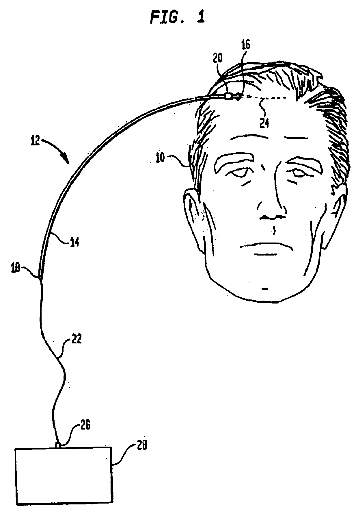 Infusion device and method for infusing material into the brain of a patient