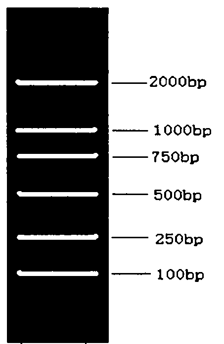 Reagent case for detecting 1594A &gt;C mutation of large vestibular aqueduct related gene SLC26A4