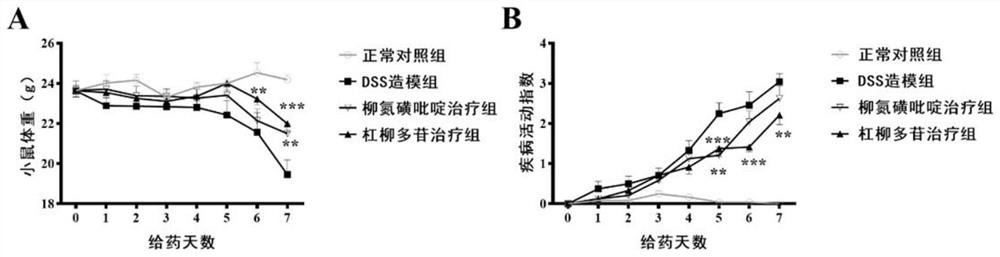 Periplocin composition, and preparation method thereof and application thereof in preparation of medicine for treating autoimmune diseases