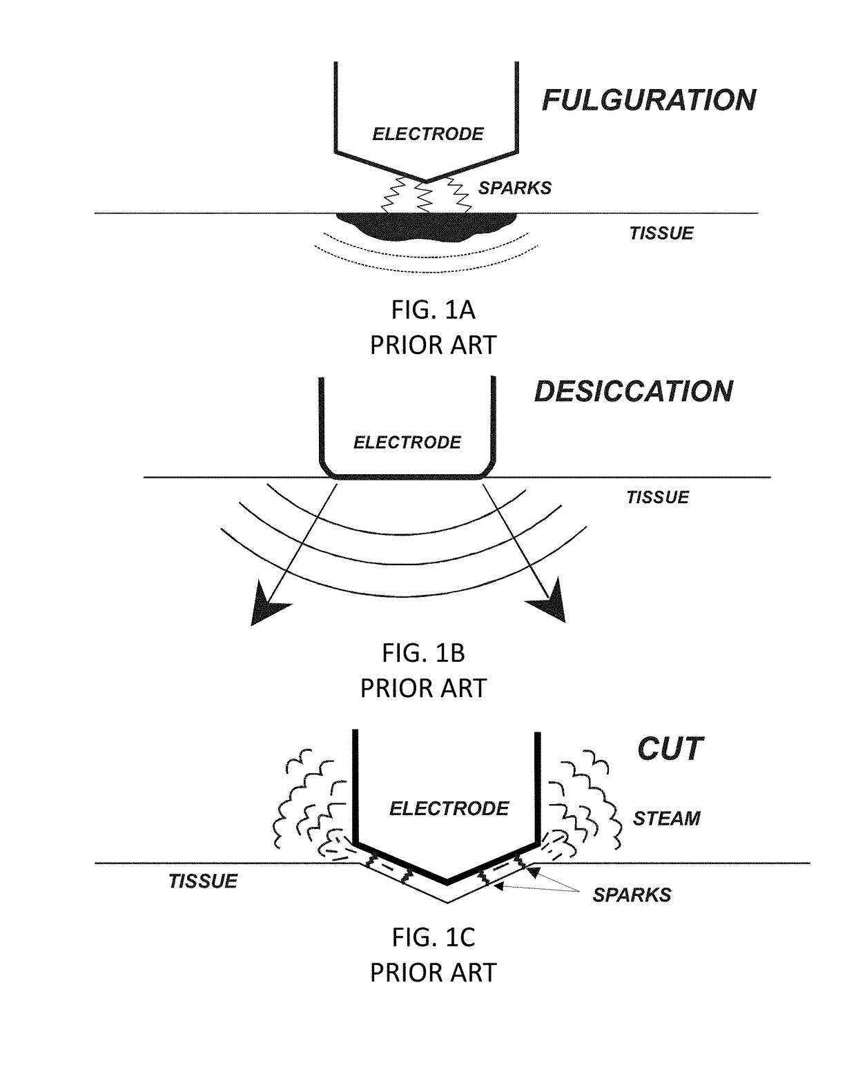 System and method for electrosurgical conductive gas cutting for improving eschar, sealing vessels and tissues