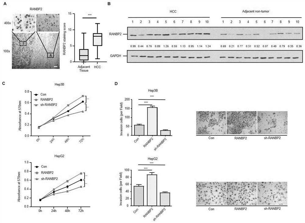 Application of cebpα as the target site of ranbp2 in the preparation of glycosylation drugs for the treatment of liver cancer