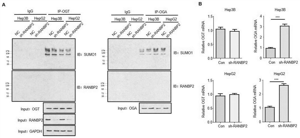 Application of cebpα as the target site of ranbp2 in the preparation of glycosylation drugs for the treatment of liver cancer