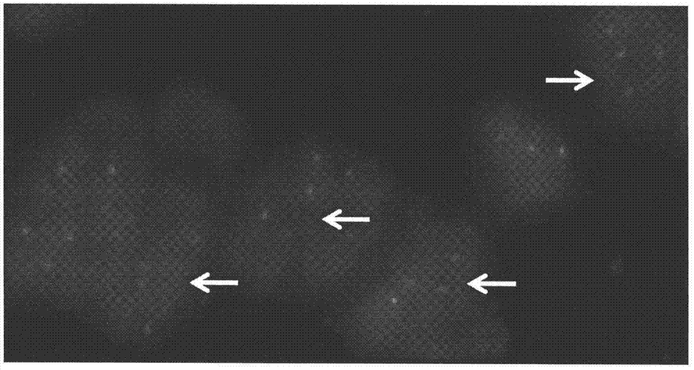 Aspl‑tfe3 fusion renal cancer gene probe and its kit application