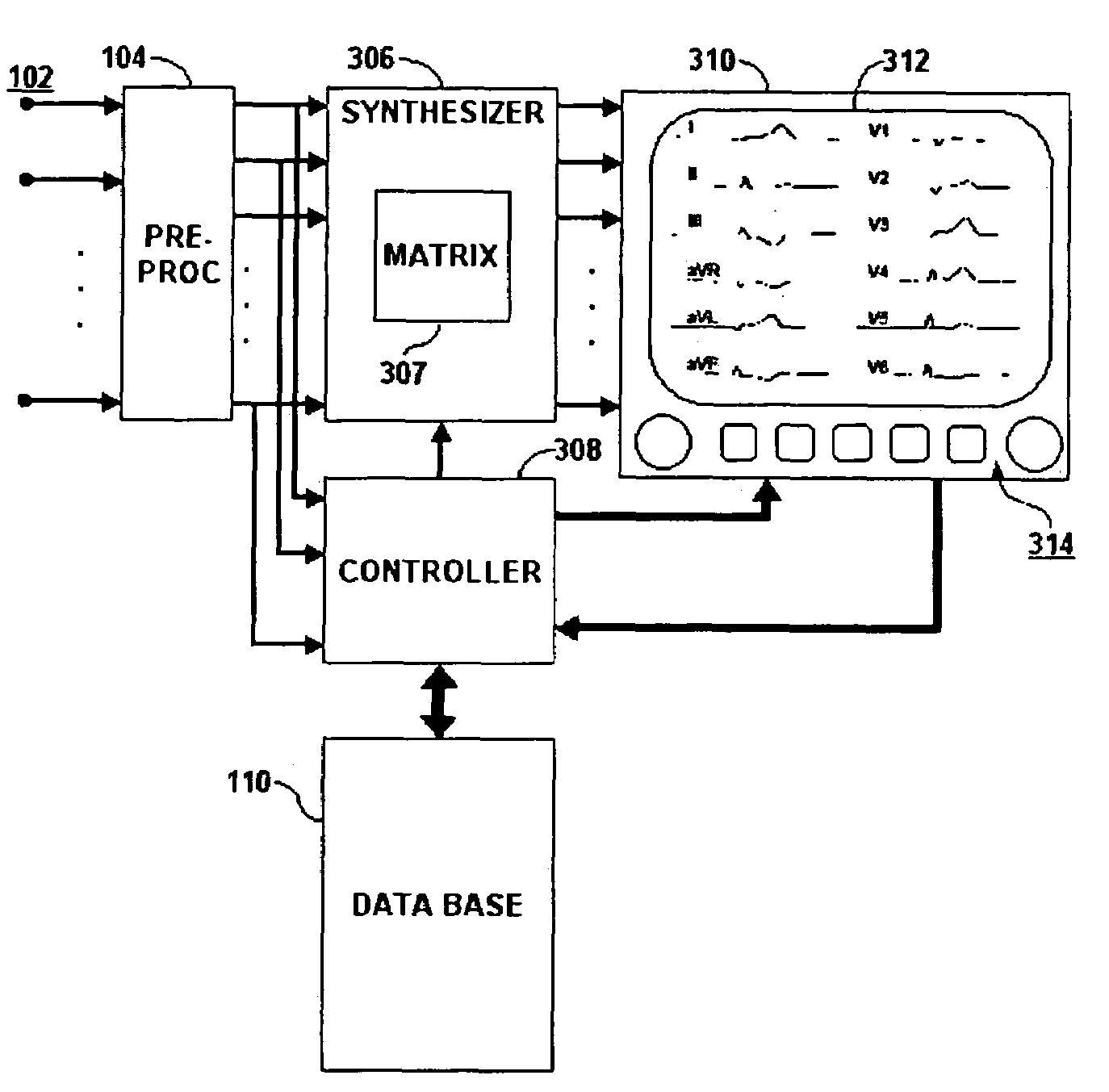 User interface system for use in ECG signal derivation and management