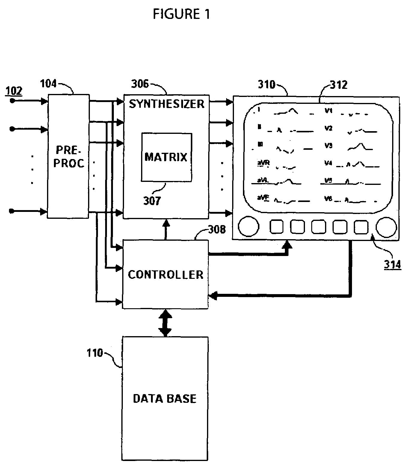 User interface system for use in ECG signal derivation and management