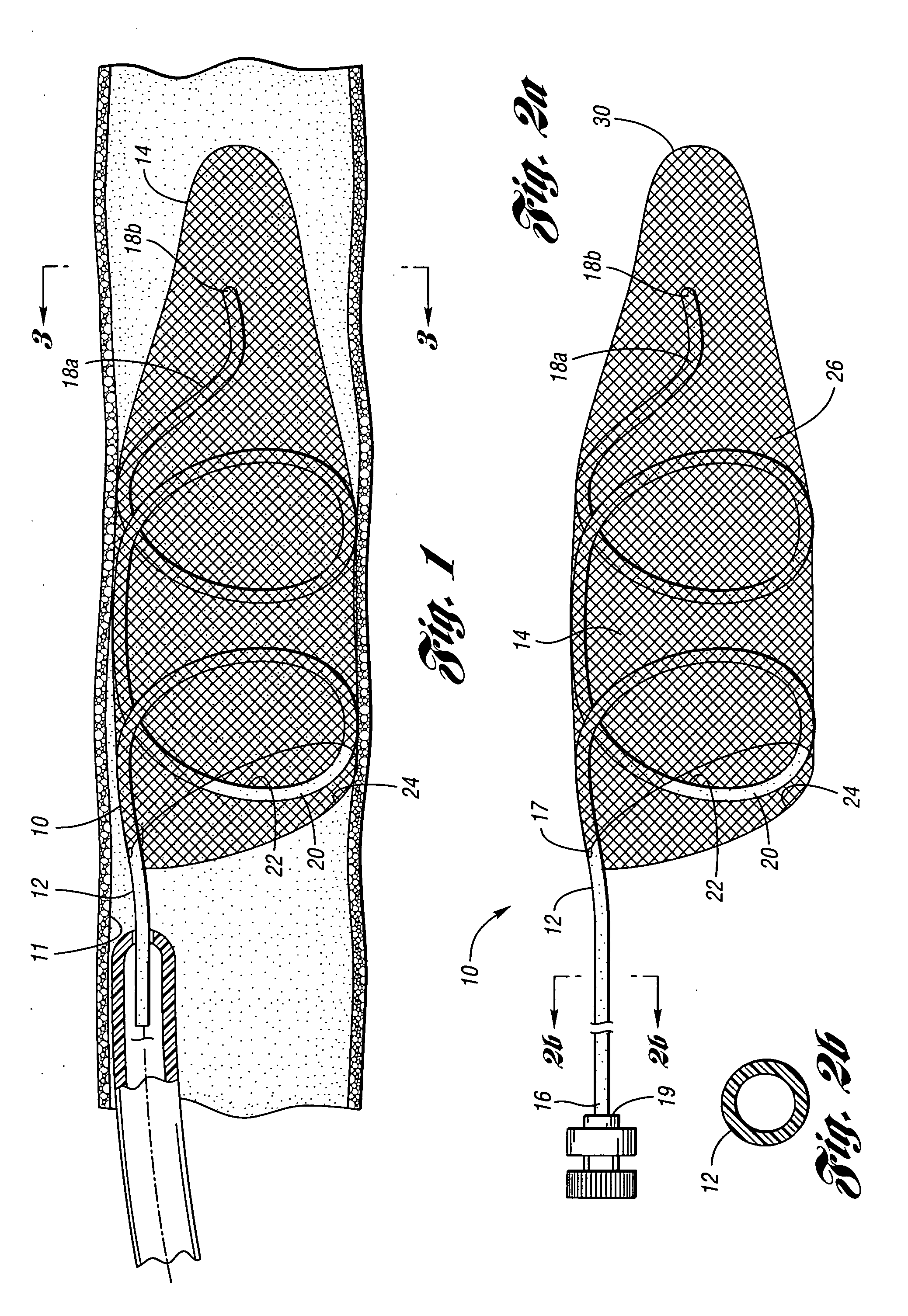 Embolic protection device having inflatable frame