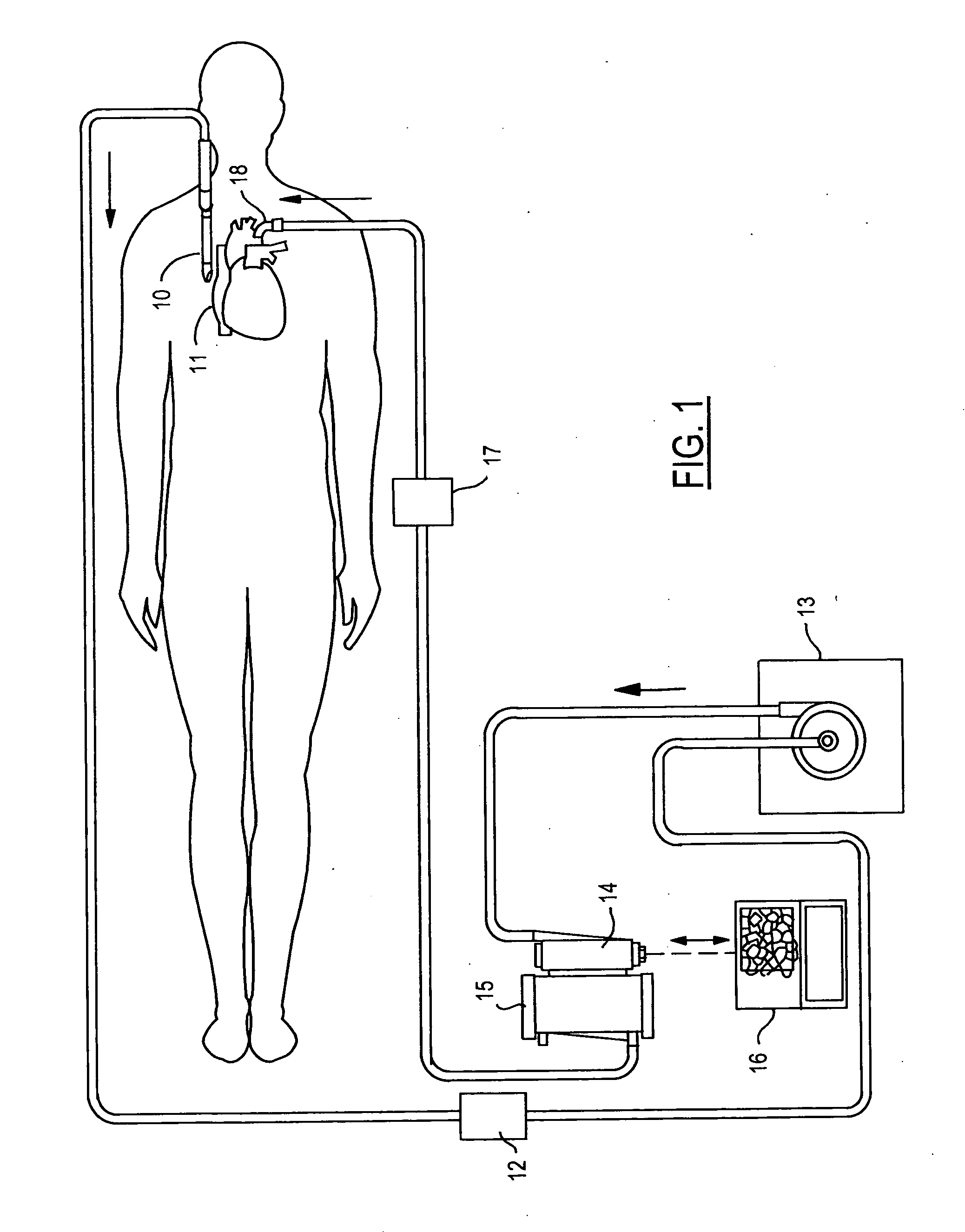 Air removal device with float valve for blood perfusion system