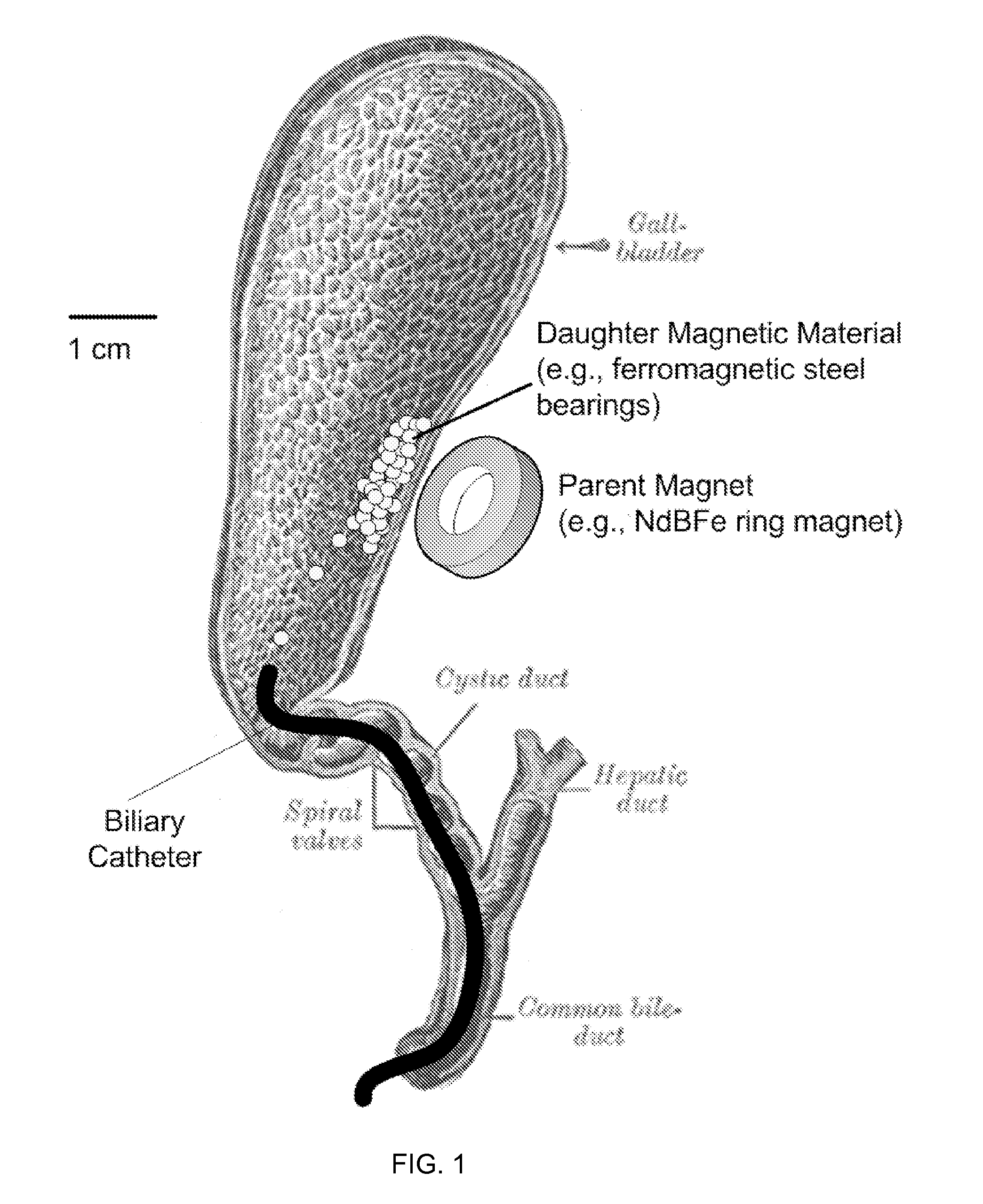 Methods and apparatus for magnet-induced compression anastomosis between adjacent organs