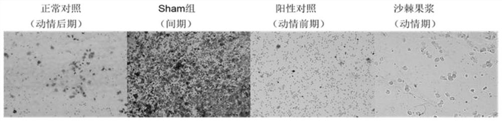 Application of seabuckthorn pulp in the treatment of polycystic ovary syndrome