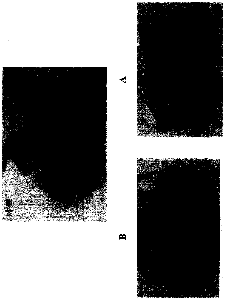 Composition for treating and/or preventing gastric ulcer and use thereof