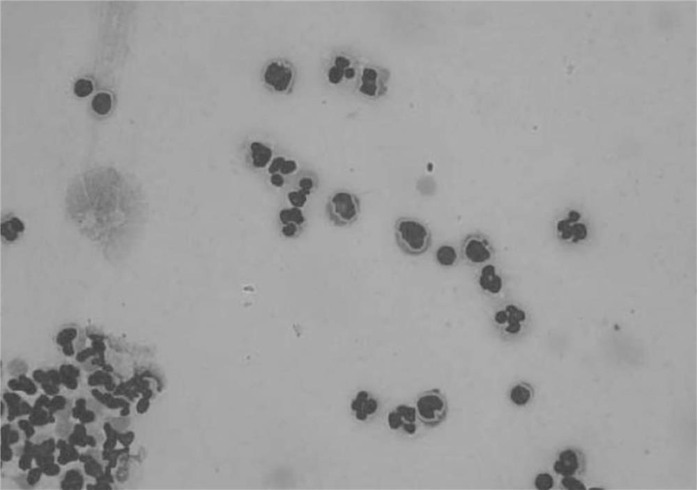 Cerebrospinal fluid cell feature extraction method based on gray level co-occurrence matrix