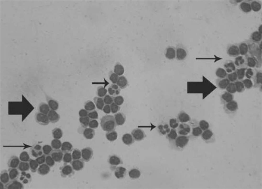 Cerebrospinal fluid cell feature extraction method based on gray level co-occurrence matrix