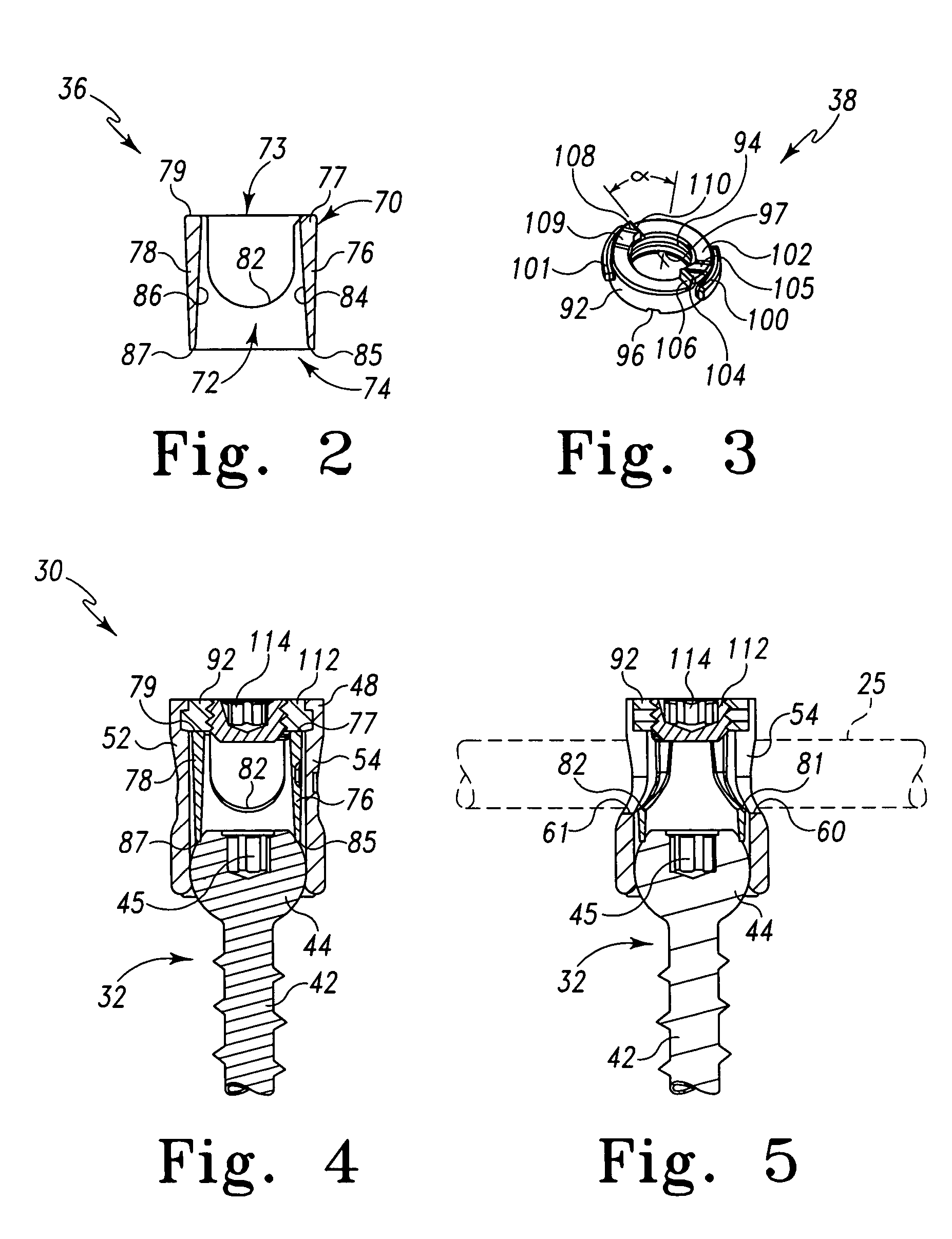 Pedicle screw constructs for spine fixation systems