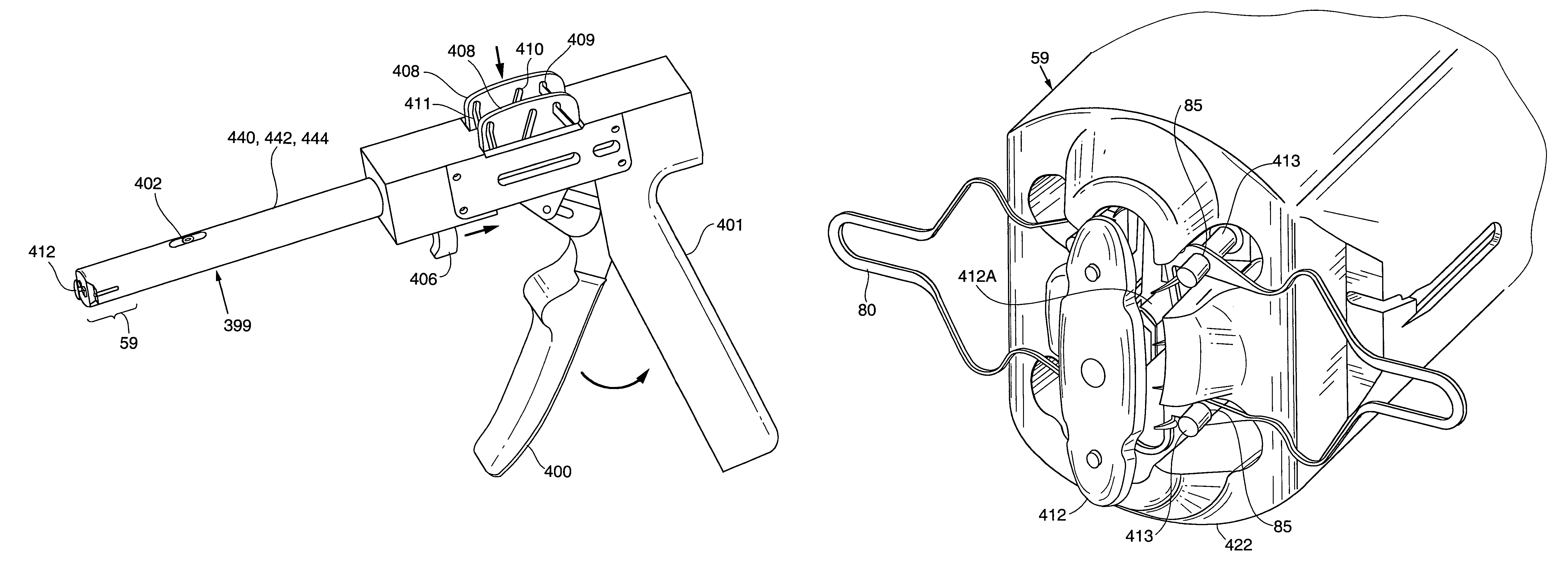 Method and apparatus for performing anastomosis with eversion of tissue edges and joining of exposed intima of the everted tissue