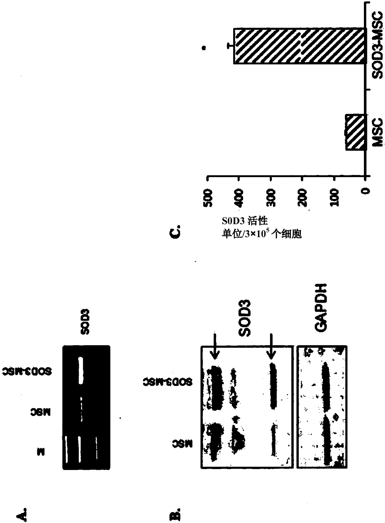 Composition for preventing or treating inflammatory diseases, containing, as active ingredient, stem cells overexpressing sod3