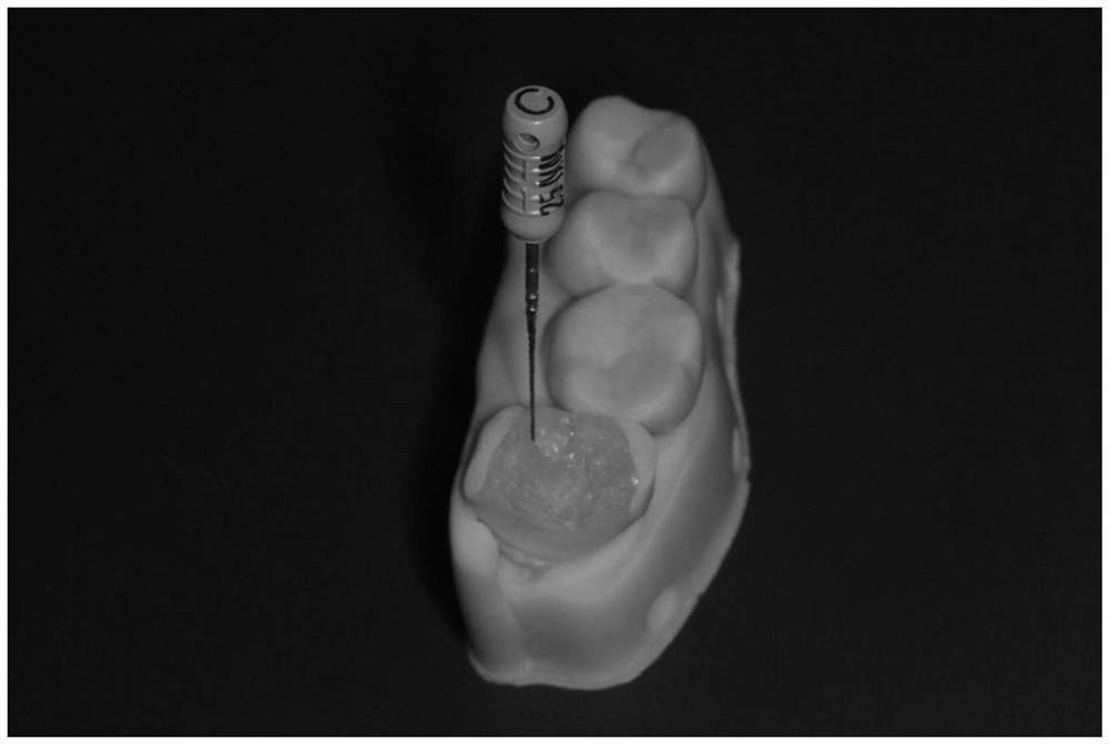 Embedded guide plate for precise positioning of root canals and its preparation method, preparation system, application, method for precise positioning of root canals