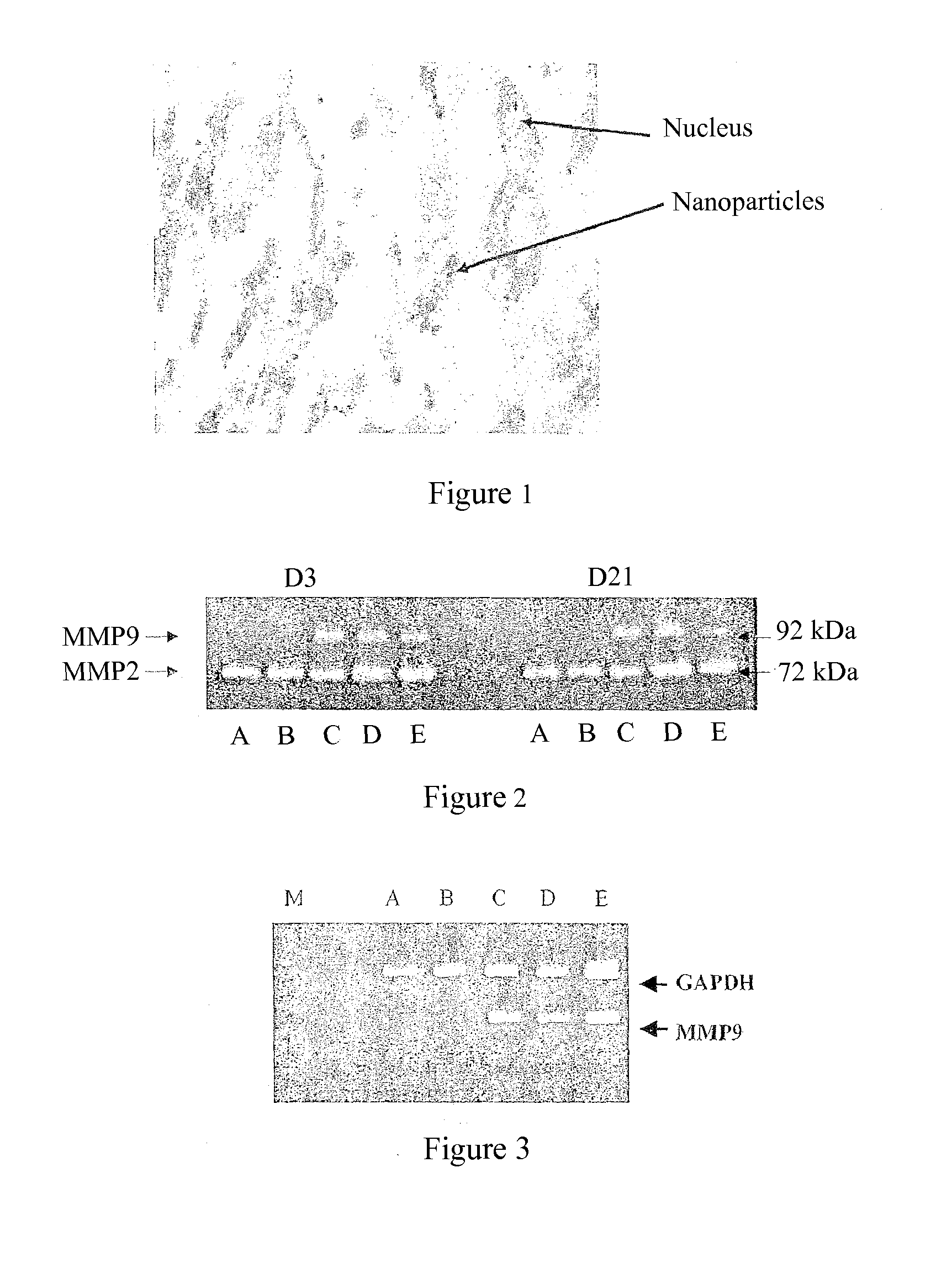 Use of gingival fibroblasts for vascular cell therapy