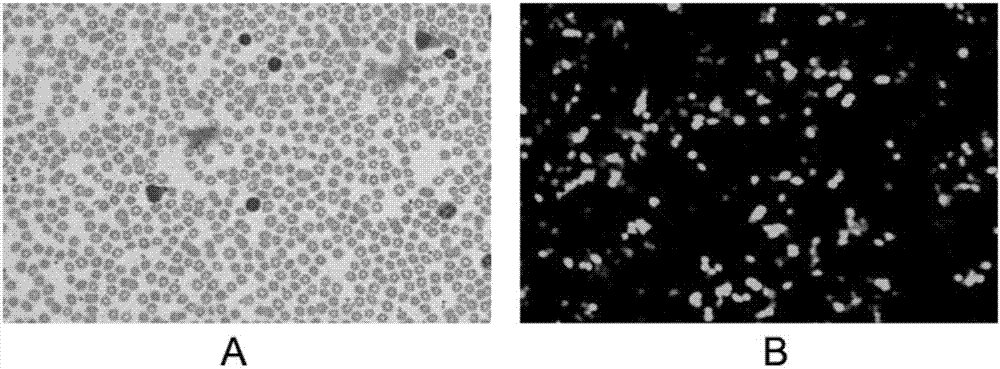 Targeted PD-L1 mosaic antigen receptor modified T lymphocyte as well as preparation method and application thereof