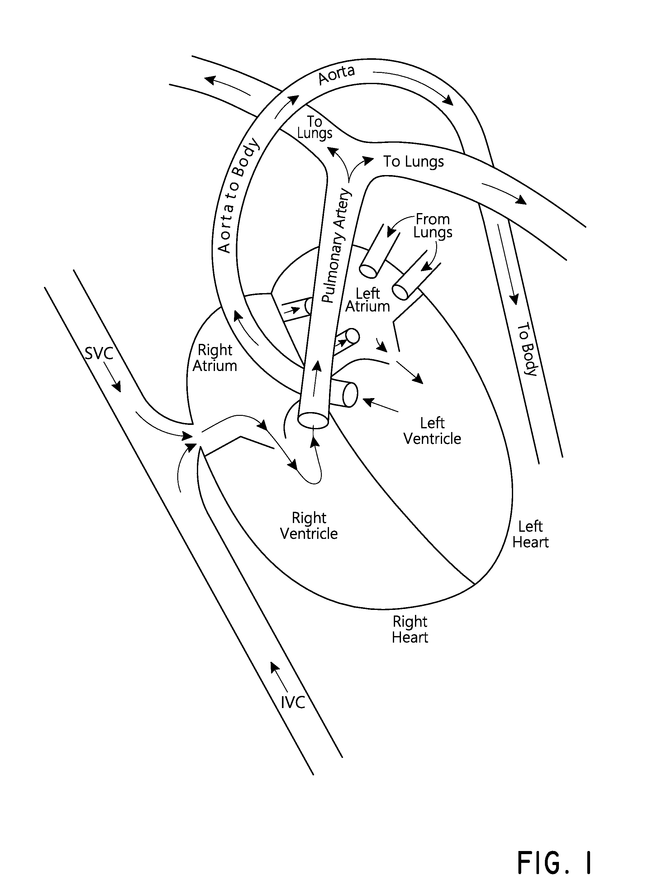 Medical devices and methods for creating bubbles