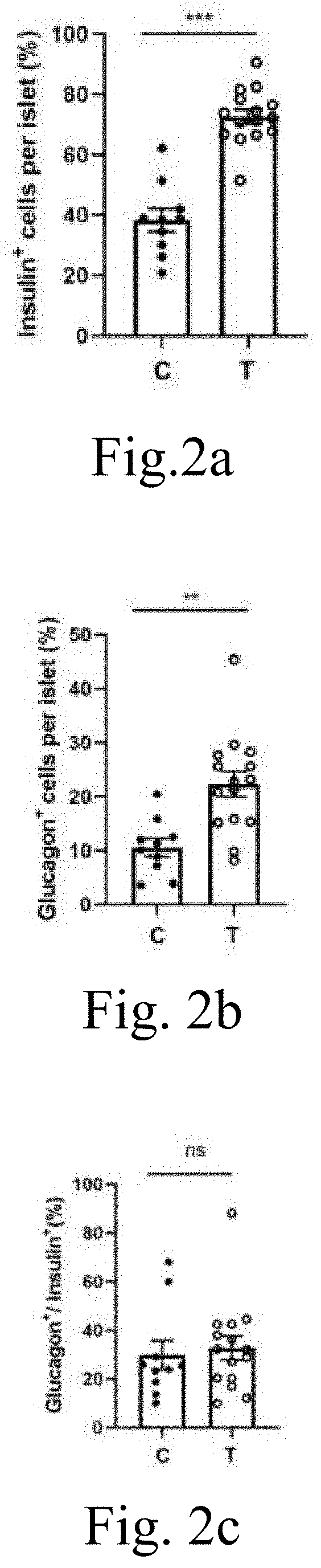 Composition for treating diabetes based on traditional Chinese medicine nutritional therapy and application thereof