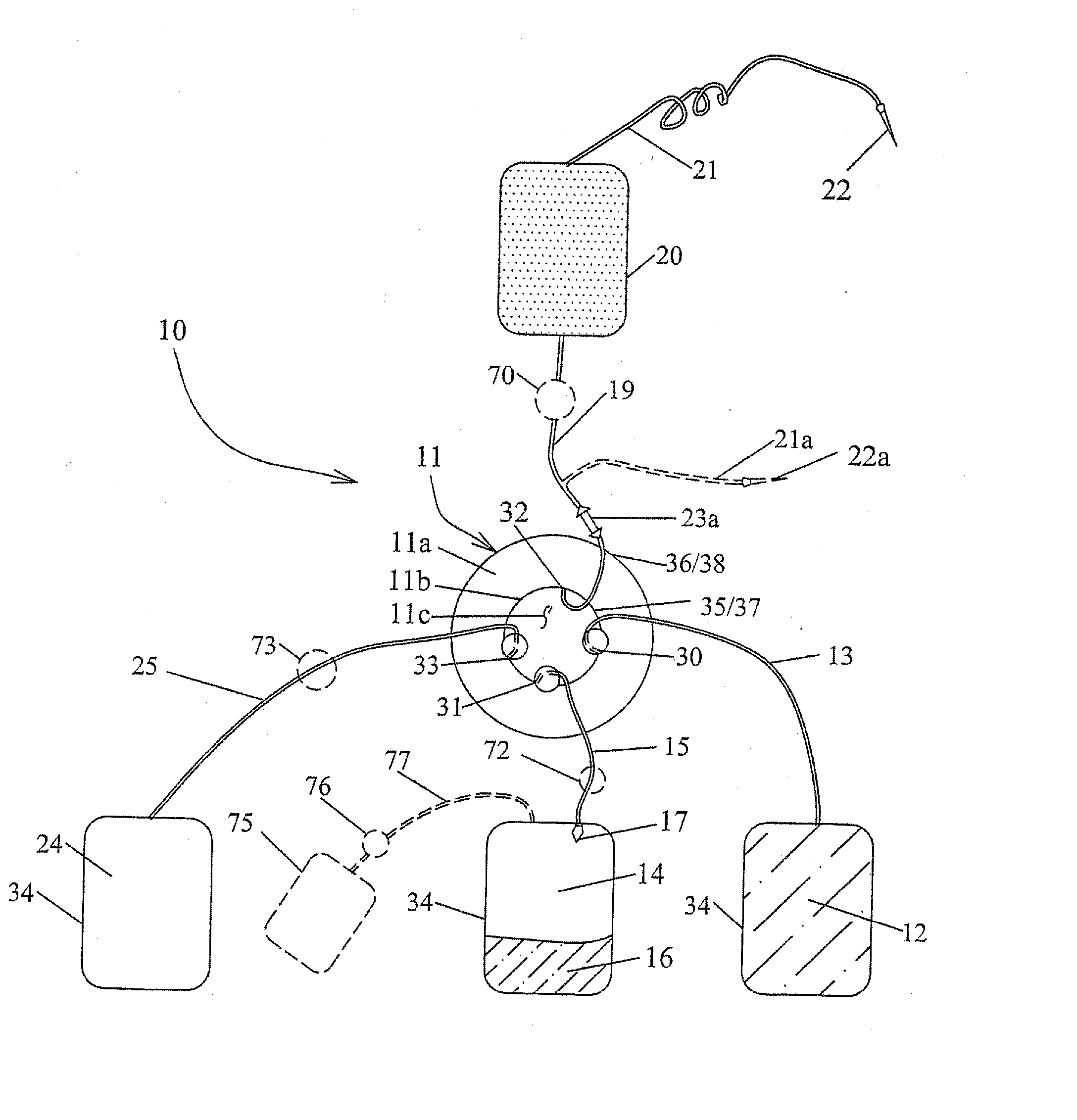 Methods and Apparatus for Blood Component Separation