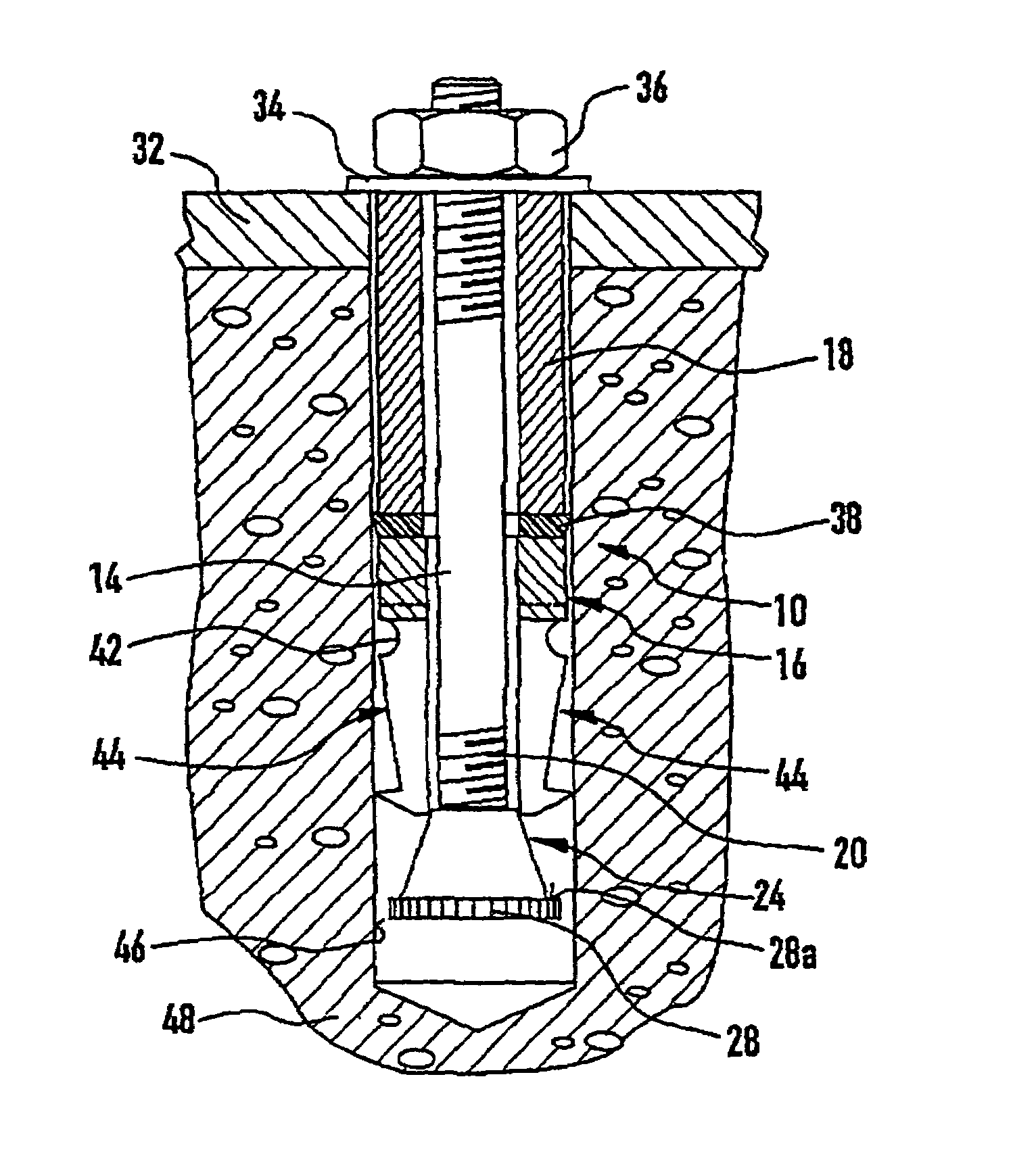 Undercut anchor element that can be mounted with positive engagement