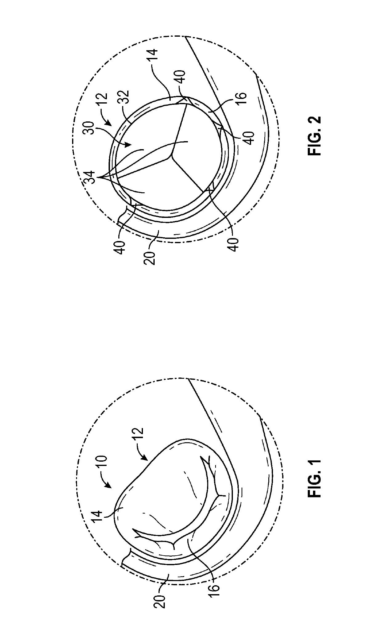 Methods and devices for reducing paravalvular leakage
