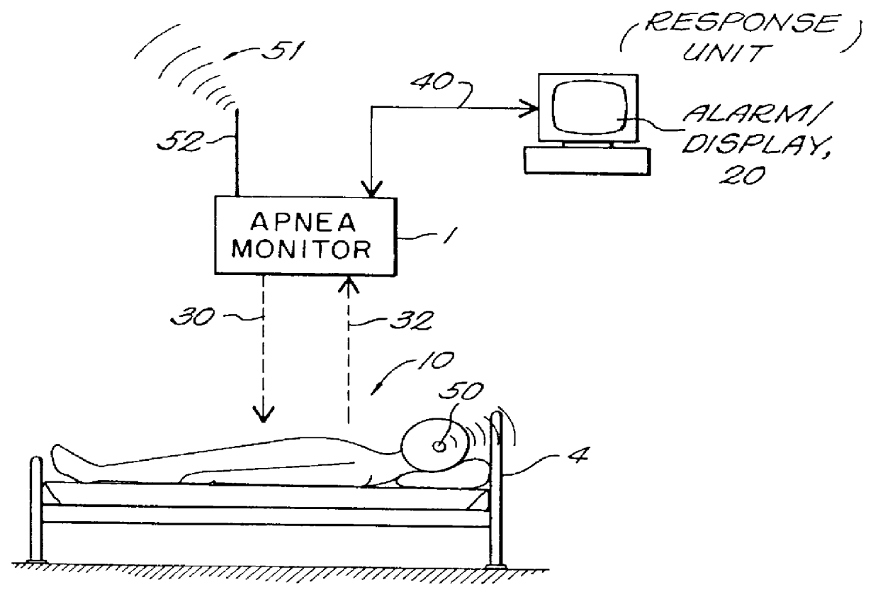Sleep apnea detector system
