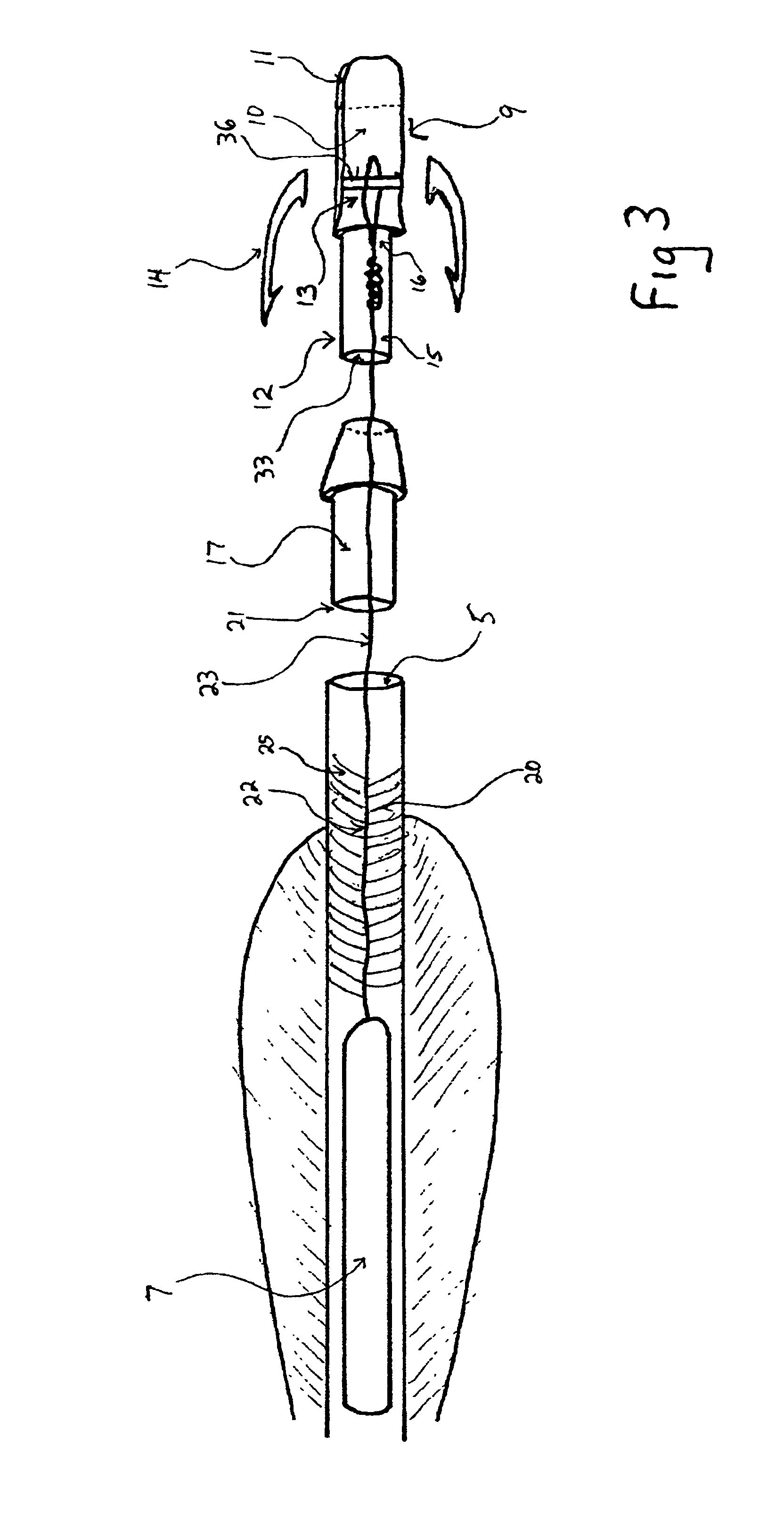 Detachable nock for detaching a locator from an arrow